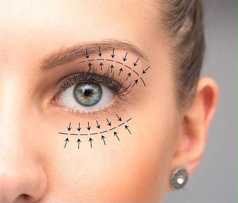 Lidchirurgie (Blepharoplastik) im EsteCenter Istanbul