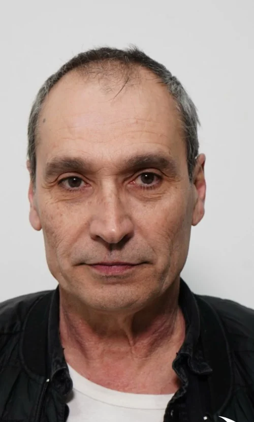 Vor der Haartransplantation