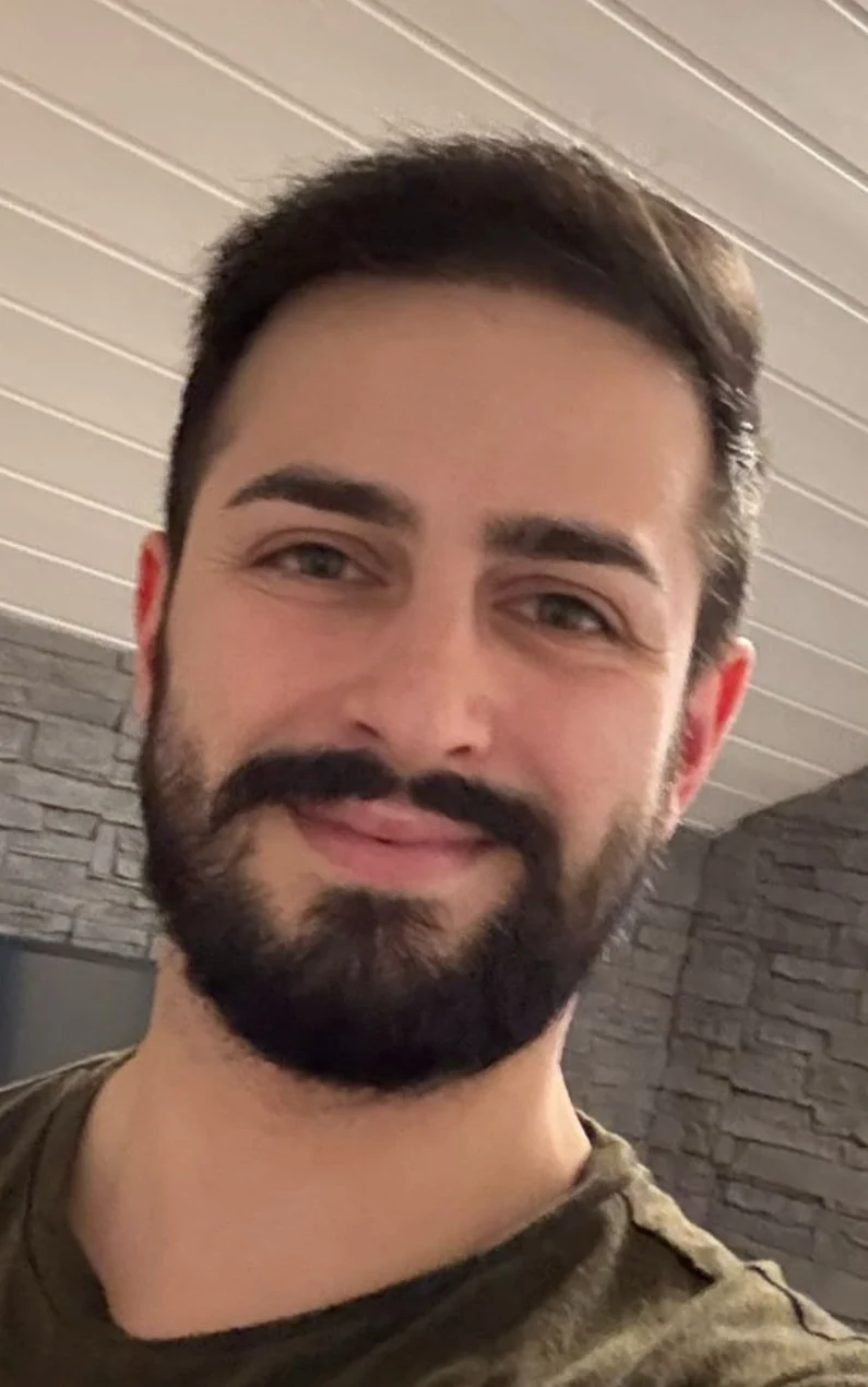 Ergebnis nach Haartransplantation