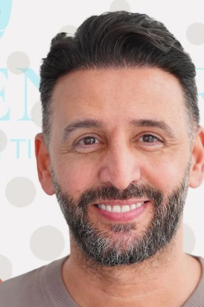 Ergebnis nach Haartransplantation