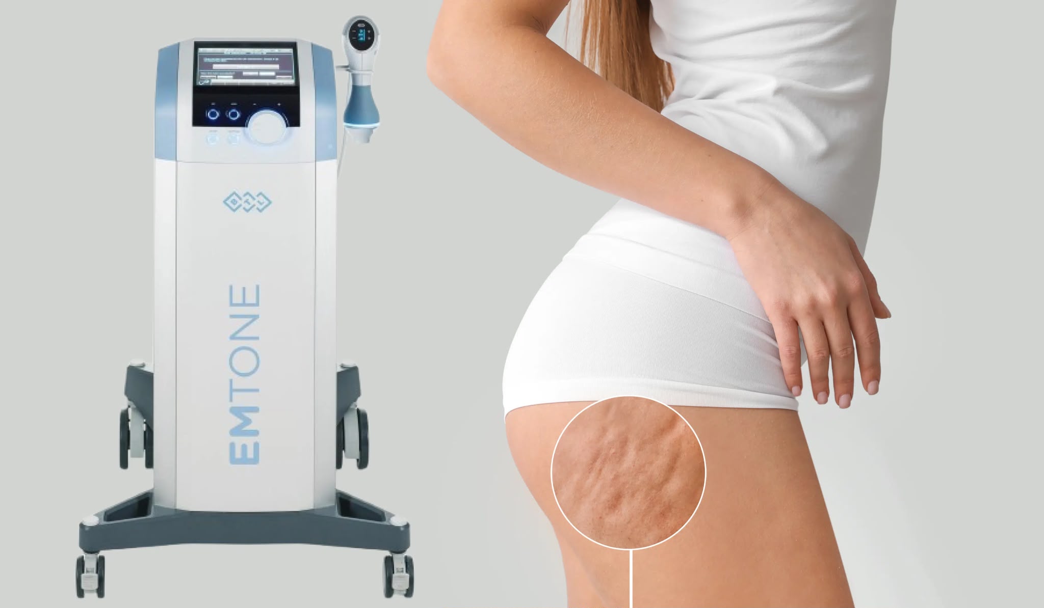 Emtone Cellulite-Behandlung bei EsteCenter Istanbul