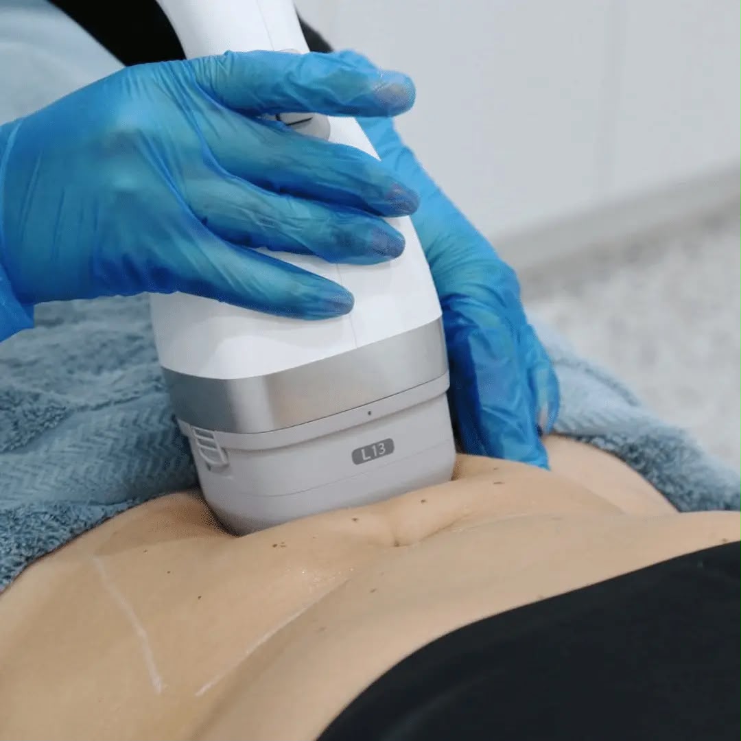 Lipocel Cool Sonic Ultraschall-Fettreduktion bei EsteCenter Istanbul