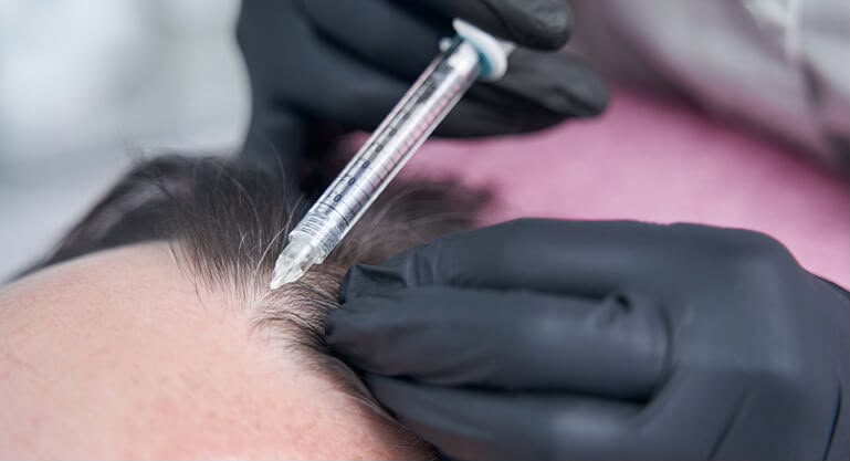 Mesotherapie Skin-Booster-Injektionen bei EsteCenter Istanbul