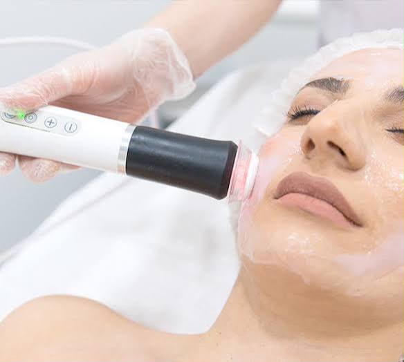 Red Touch Laser-Verjüngung bei EsteCenter Istanbul