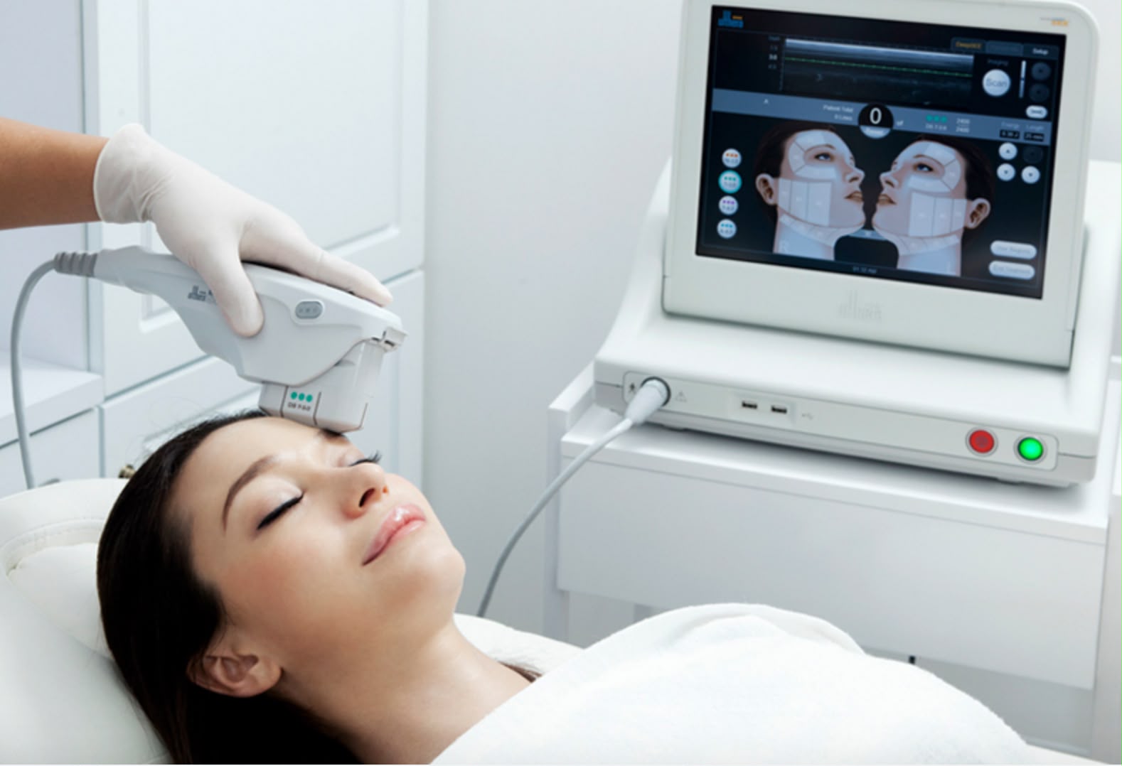 Ultherapy Ultraschall-Hautlifting bei EsteCenter Istanbul